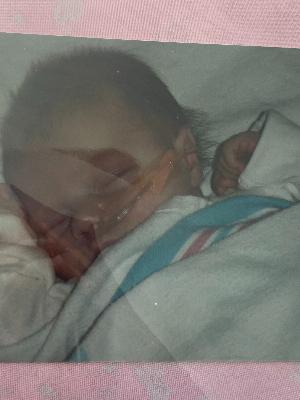 open-heart surgery, 10 days old
